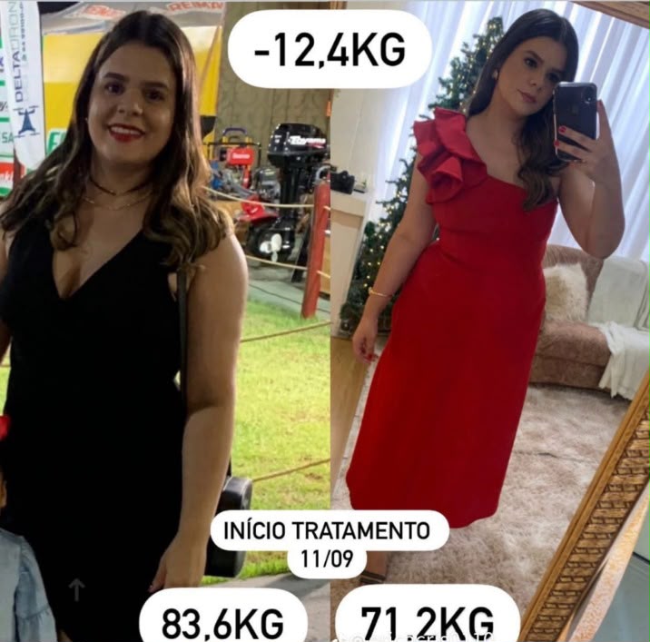 Registro de acompanhamento — Acompanhamento de 3 meses