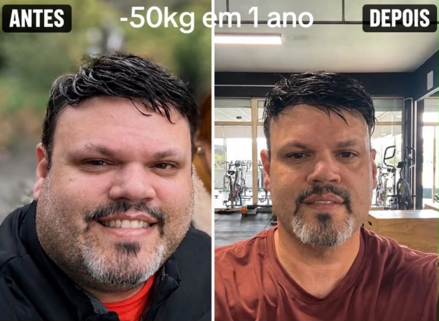 Registro de acompanhamento — Acompanhamento de 12 meses